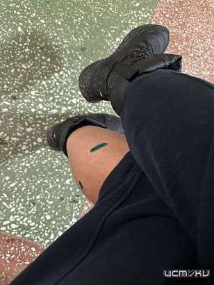 В Орле на Черкасской собаки напали на женщину