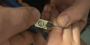 Орловчанка смогла избавиться от кольца только с помощью спасателей
