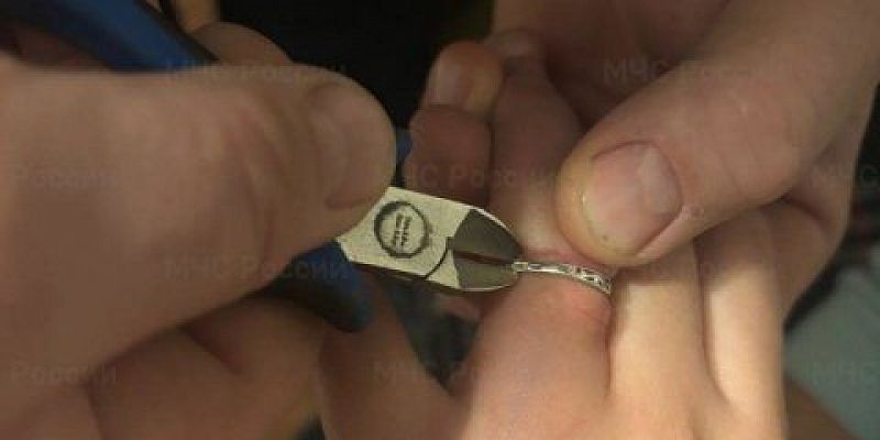Орловчанка смогла избавиться от кольца только с помощью спасателей