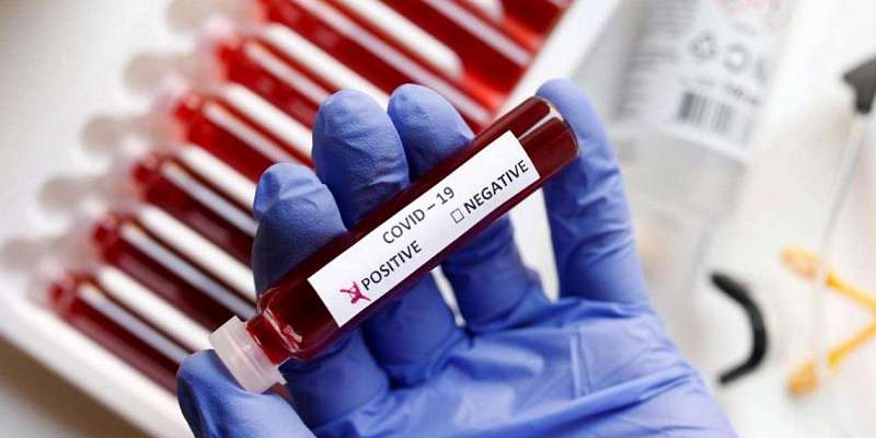 +38: на Орловщине выявлены новые случаи заражения COVID-19