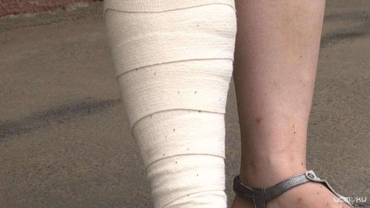 В ее доме поселились «удивительные» соседи: орловчанке мешают жить блохи