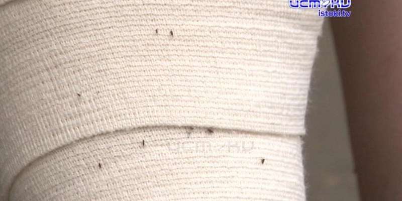 Блохи превратили жизнь орловчанки в кошмар, а УК на помощь не спешит