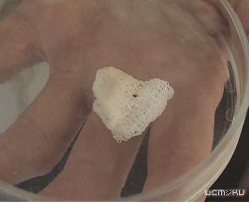 С 13 по 16 апреля парки Орла будут обрабатывать от клещей