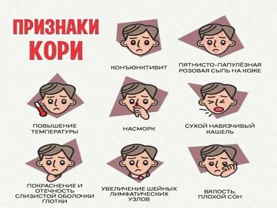 В Орловской области зарегистрировано два случая кори