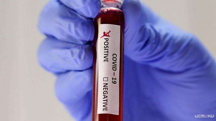 Без анализа на COVID-19 орловчане не смогут лечь в больницу