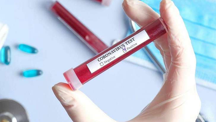 Стабильный прирост: на Орловщине COVID-19 подтвердился ещё у 51 человека