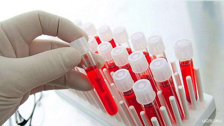 Число заболевших коронавирусом на Орловщине достигло 4840