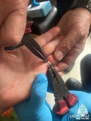 Орловчанка не смогла снять кольца без помощи спасателей Орловчанка не смогла снять кольца без помощи спасателей
