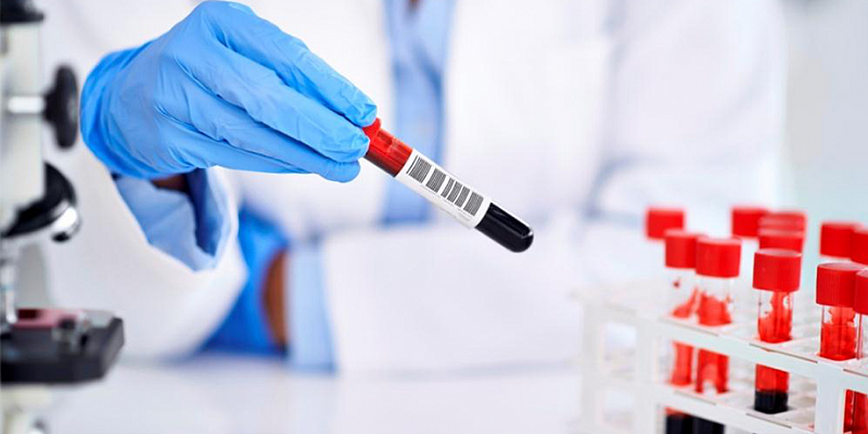 Как готовиться к сдаче анализов на гепатит