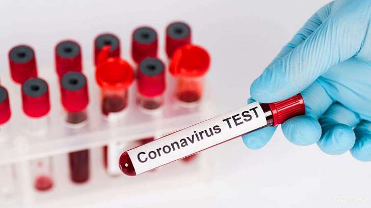 За сутки еще 51 орловчанин подхватил коронавирус