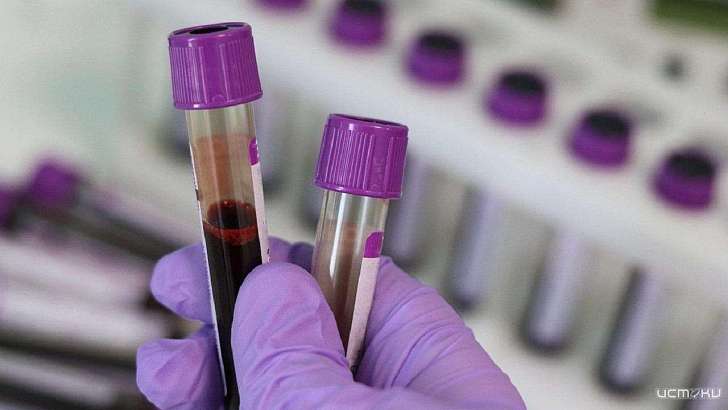 Вновь бьем рекорды: за сутки диагноз COVID-19 подтвердился у 125 орловчан