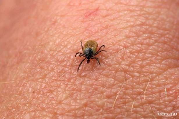 В Орловской области ещё 3 жителей заразились от клещей болезнью Лайма