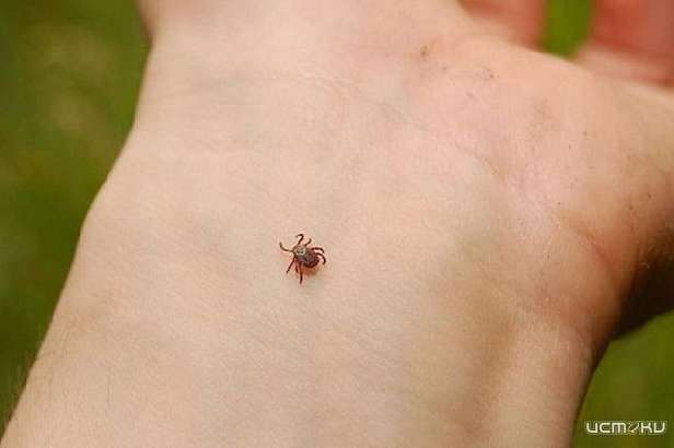 30 детей пострадало в Орловской области от укусов клещей  30 детей пострадало в Орловской области от укусов клещей