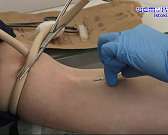 В День донора орловчане массово сдавали кровь