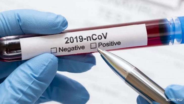 Орловчане не могут добровольно провериться на коронавирус 