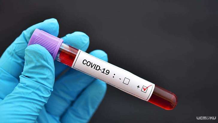 Еще трое пациентов с коронавирусом умерли в Орловской области