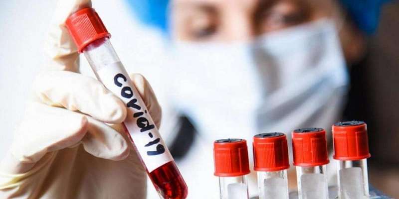 В Орловской области коронавирус выявлен еще у 19 человек