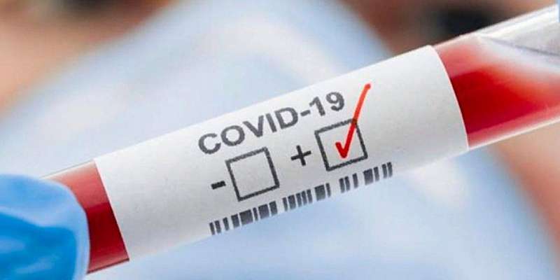 +60: на Орловщине число зараженных коронавирусом превысило 4000