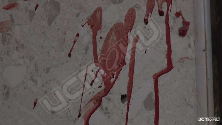 Расправа средь бела дня: фото с места убийства в Орле