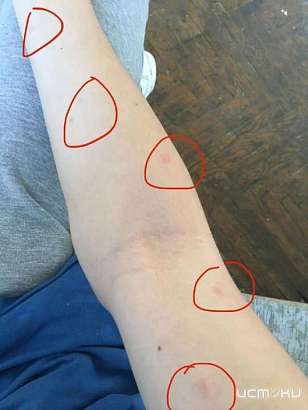 Купание в озере Светлая жизнь обернулось неприятным сюрпризом для орловчанина