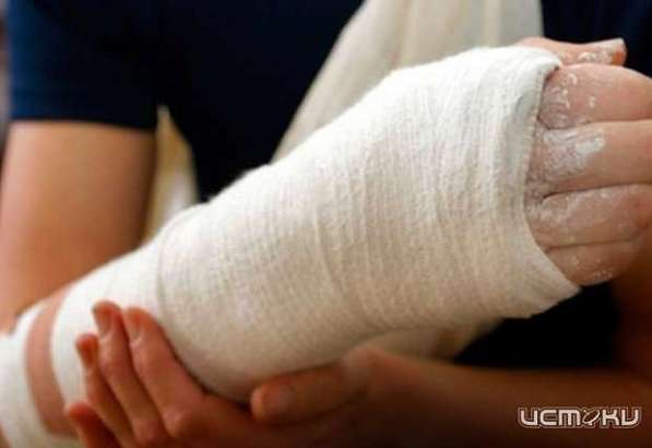 Орловчанка сломала руку, упав на льду