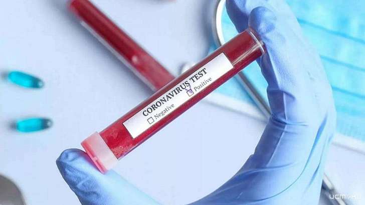 Губернатор рассказал о состоянии троих орловчан, зараженных коронавирусом