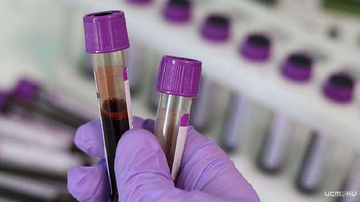 +85 за сутки: число зараженных COVID-19 на Орловщине стремительно растет