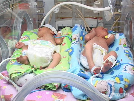 Четвертый случай за 27 лет: в Орле родилась тройня 