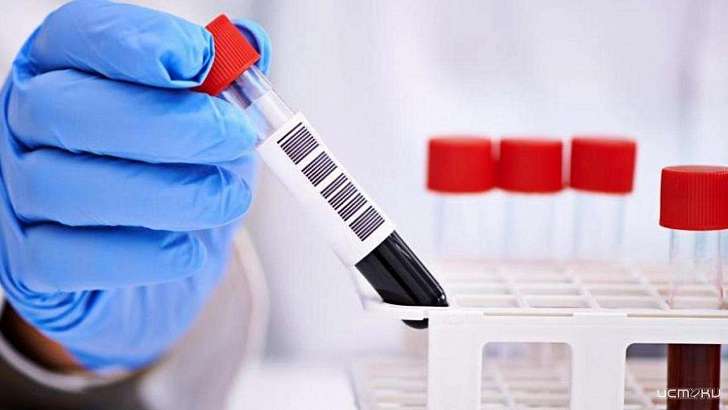 Орловчане жалуются на проблемы с тестами на коронавирус