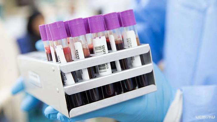 За сутки коронавирус нашли еще у 31 орловчанина