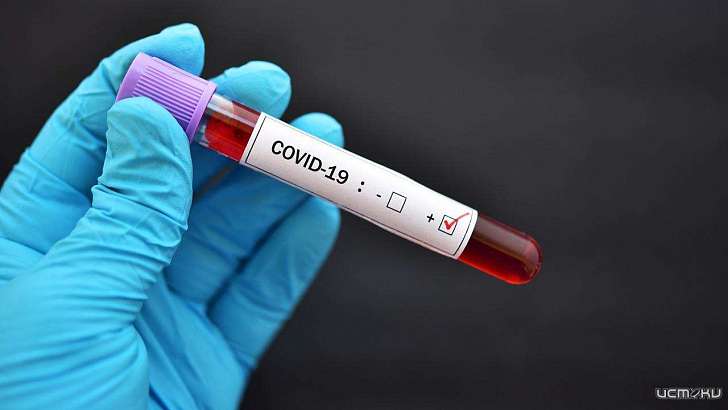 Статистику Орловщины пополнил еще один летальный случай COVID-19