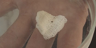 С 13 по 16 апреля парки Орла будут обрабатывать от клещей