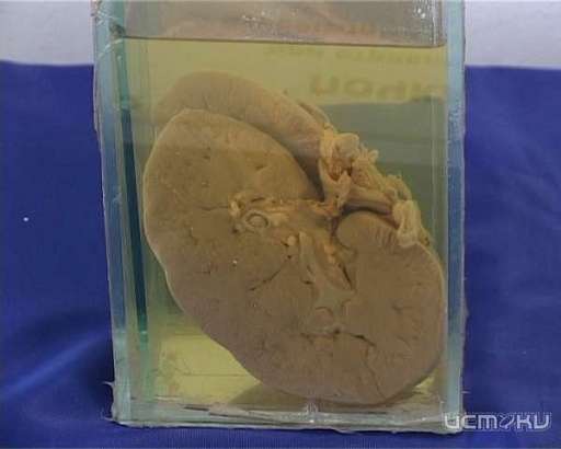 Шоковая терапия для подрастающего поколения. В Орловском краеведческом музее открылась анатомическая выставка 