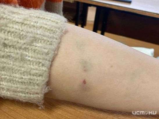 Бастрыкин взял на контроль ситуацию с нападениями бродячих псов в Орле