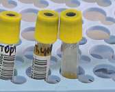 Лаборатория «СанаТест» приглашает орловчан на открытие нового центра