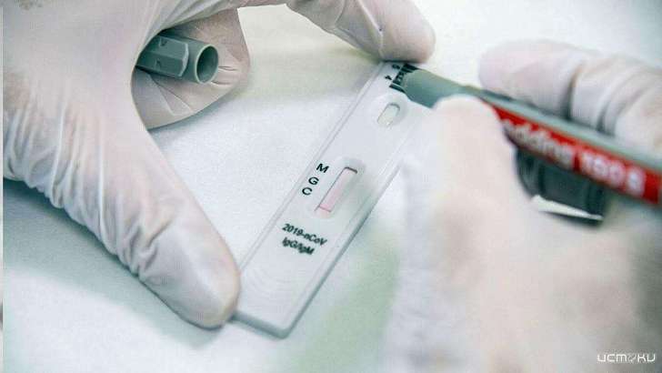 На Орловщине начали экспериментировать с экспресс-тестами на COVID-19