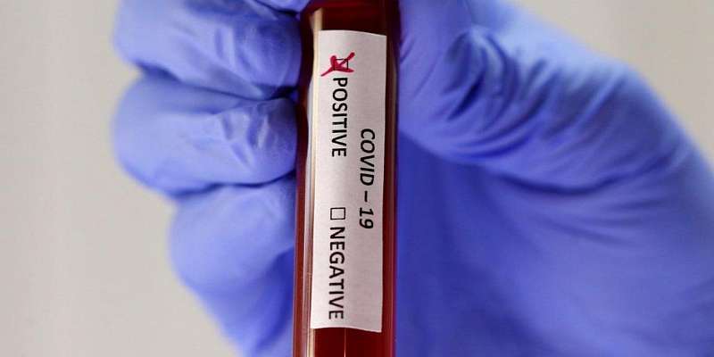 Коронавирус в Болхове: 3 жителя с подтвержденным диагнозом