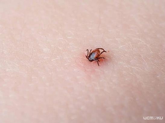 В Орловской области 14 человек обратились в медицинские организации с жалобами на присасывание клещей