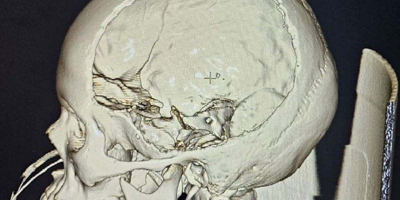 Орловские врачи спасли ребенка с редким заболеванием