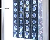 Новости за 90 секунд: Орловская область получит на ремонт дорог еще 450 млн рублей, спасатели обследуют пляжи Орловской области, а в Орле выбрали учит...