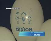 Как отметили Международный день защиты детей в орловской клинике DIXION