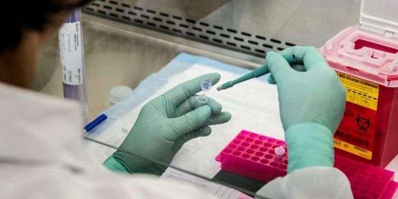 За сутки на Орловщине было выявлено ещё 34 случая заражения коронавирусом