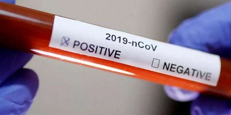 На Орловщине сделали более 30 тысяч тестов на коронавирус