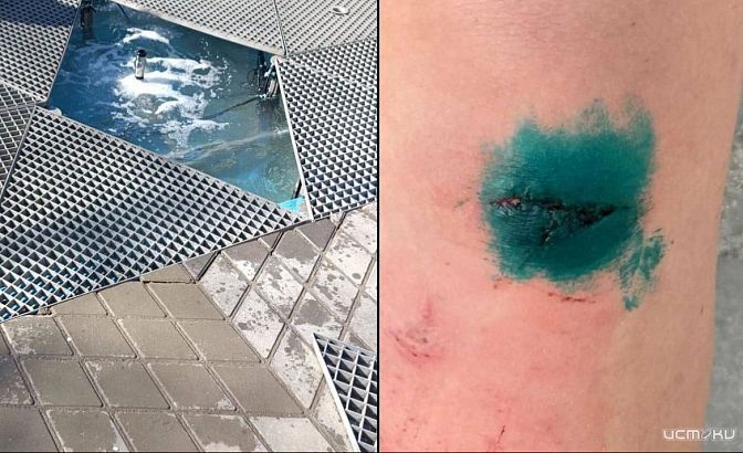 В Ливнах трое детей получили серьезные травмы на сломанном фонтане