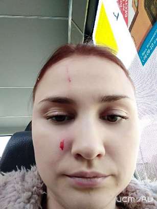 "Это не шутки, мы встретились в маршрутке": орловчанке в транспорте расцарапали лицо