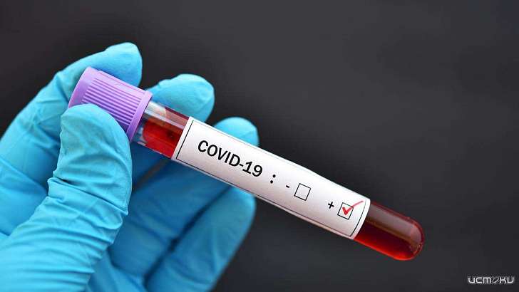 +32 заболевших и 63 выздоровевших: новые данные по COVID-19 на Орловщине