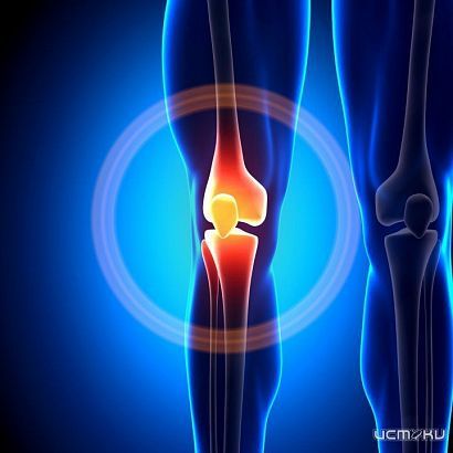 Что делать, если болят суставы после физических нагрузок