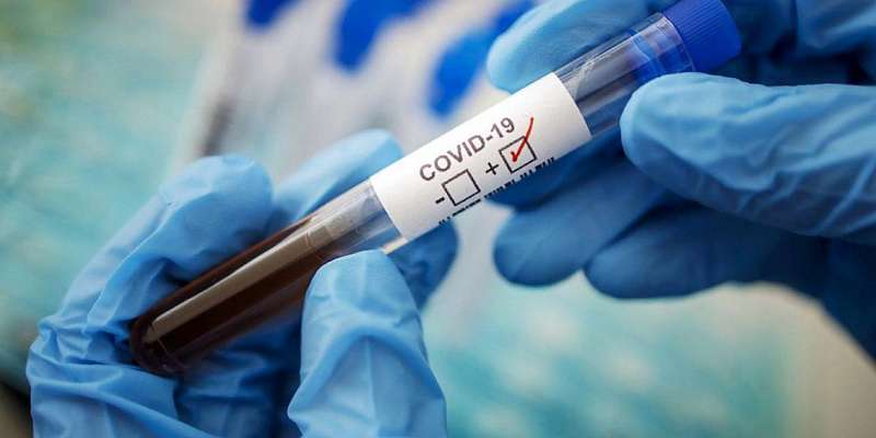 На Орловщине число заболевших COVID-19 перевалило за пять тысяч