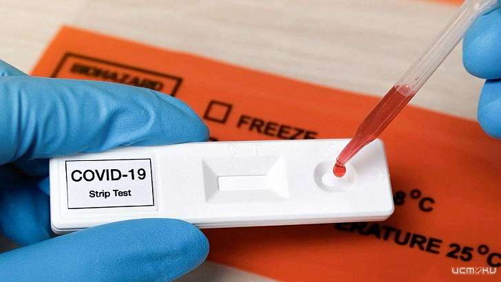 Более 500 орловчан сдали тест на антитела к коронавирусу