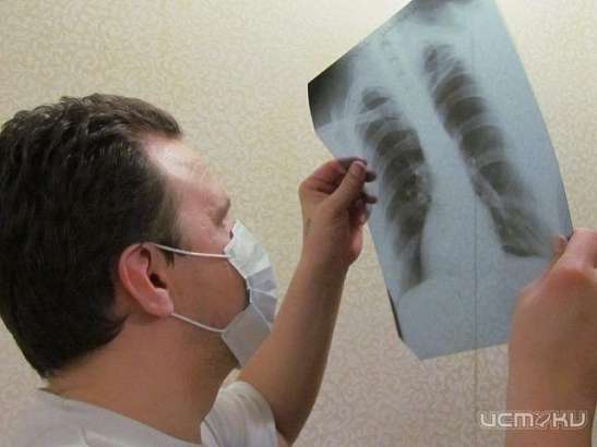 На Орловщине снизилась смертность от туберкулеза